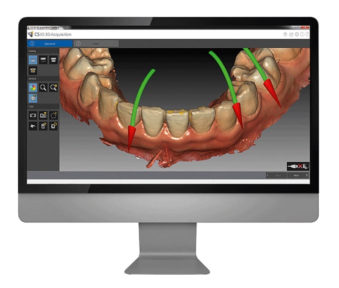 Darstellung einer digitale Abformung am Computerbildschirm